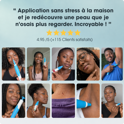 Dermaclear Pro™- Éliminez vos acrochordons en 7 jours sans douleur !
