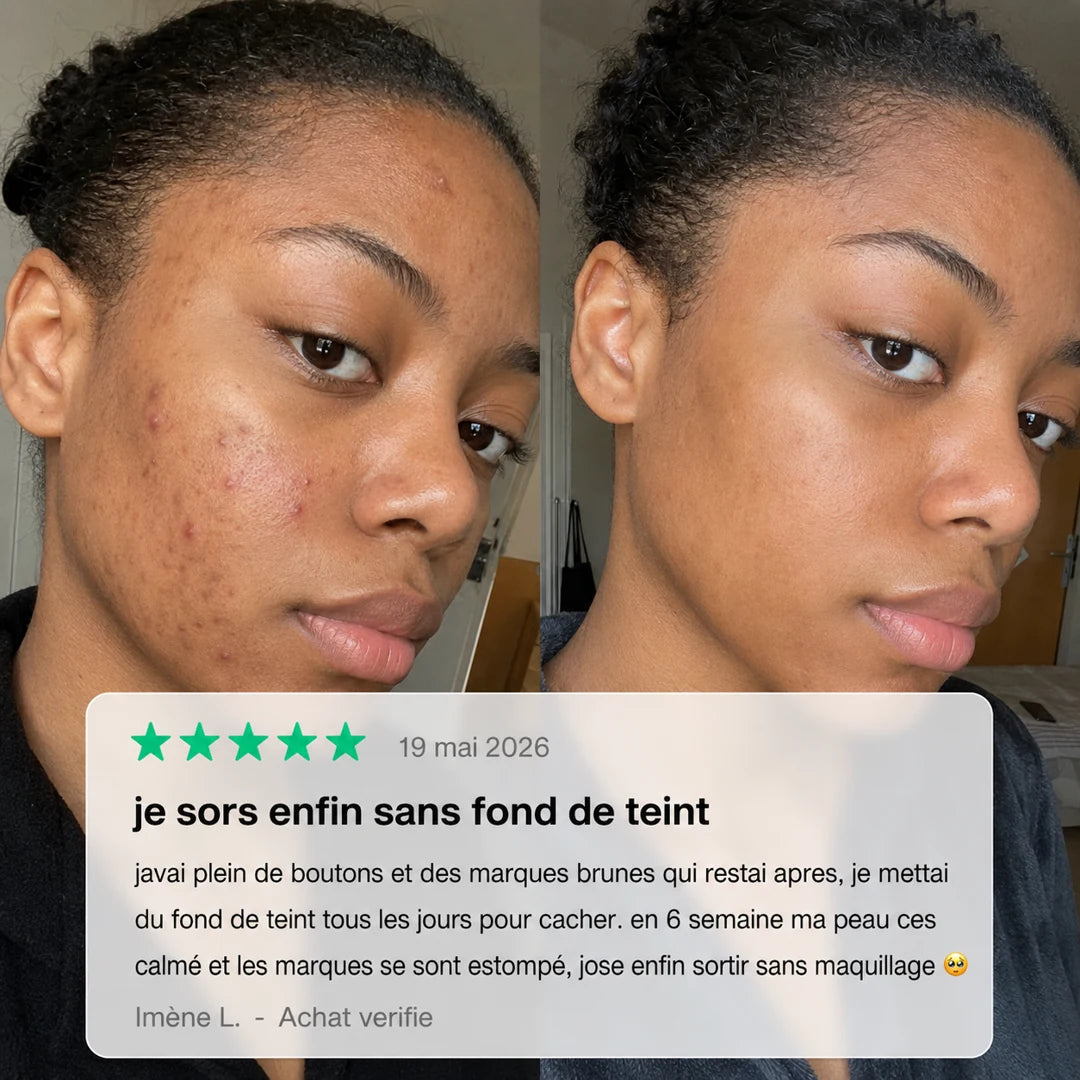 Lumin'Or — Gel exfoliant enzymes d'orange.